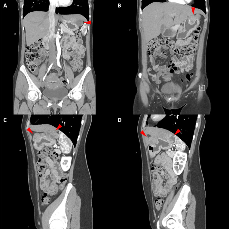 Fig. 3  