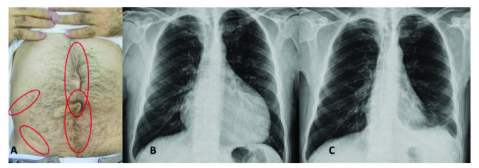 包含圖片、插圖等的外部文件。對象名稱為 turkjmedsci-50-1591-fig001.jpg